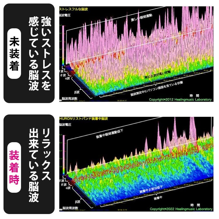 HURON チューニングバンド未装着・装着時の脳波測定